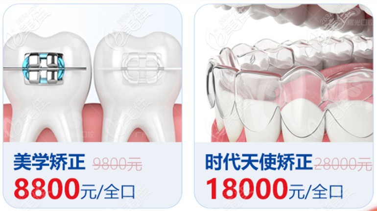 廣州曙光口腔優(yōu)惠活動細則