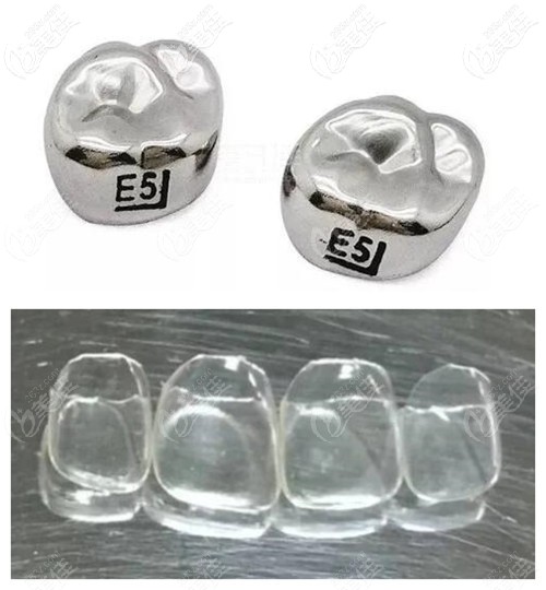 兒童戴牙冠會(huì)有副作用嗎