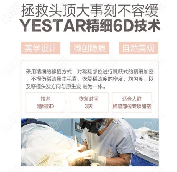 濟(jì)南植發(fā)醫(yī)院哪家好