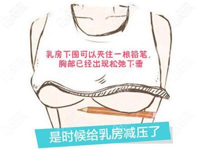 誰(shuí)做過(guò)乳房雙環(huán)懸吊提升手術(shù)