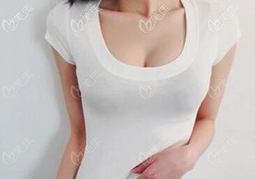 乳房懸吊術(shù)術(shù)后恢復(fù)圖片