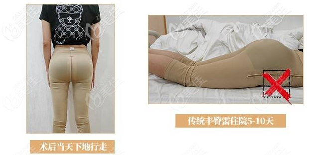 深圳曹孟君豐臀7天就可以正常坐臥行走 深圳曹孟君豐臀7天就可以正常坐臥行走