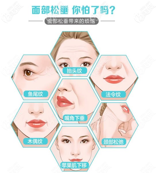 臉上嘴角紋法令紋深怎么辦