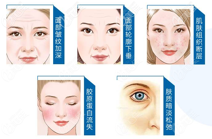 中山曙光整形醫(yī)院張玲玉醫(yī)生怎么樣 中山曙光整形醫(yī)院張玲玉醫(yī)生怎么樣