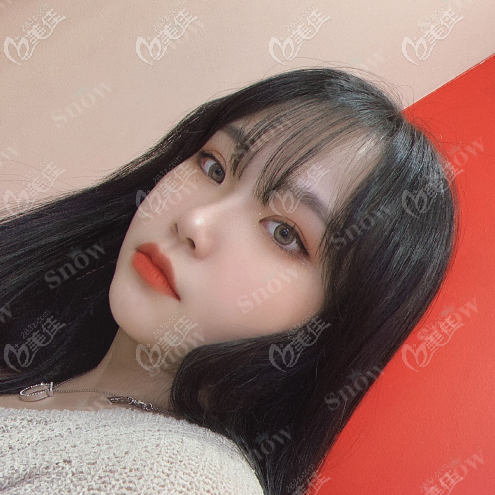 韓國吸脂價格雖然小貴，但是不會經(jīng)歷到抽脂后過程太痛苦了的感受