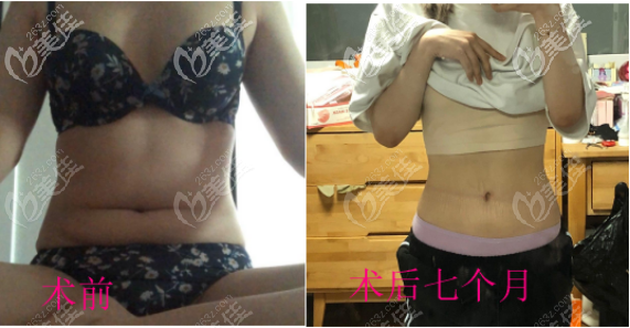 20210322_1616394342328752.png image.png