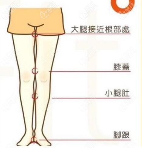 可以單獨(dú)做膝蓋內(nèi)側(cè)吸脂嗎