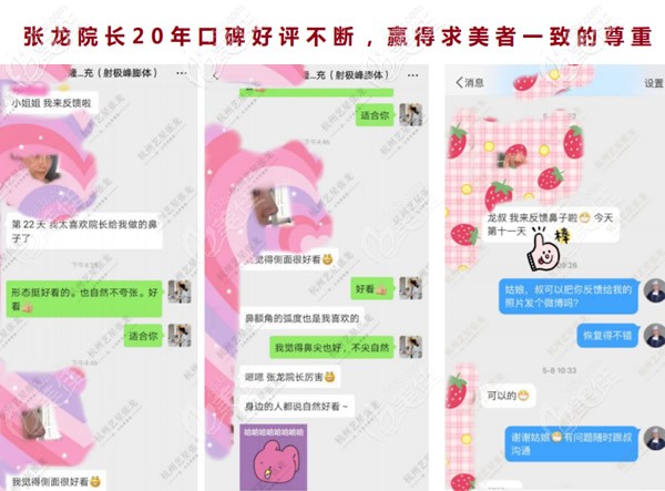 杭州藝星張龍醫(yī)生做鼻子怎么樣