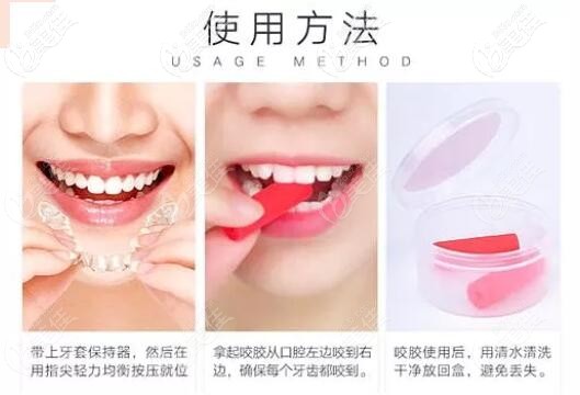 戴隱形牙套咬膠的正確方法