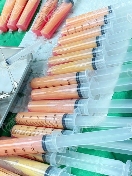 無限蘭斯瘦大腿吸脂22管 無限蘭斯瘦大腿吸脂22管