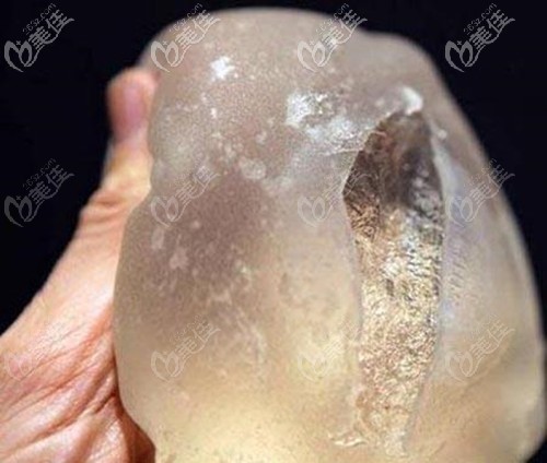 怎么判斷隆胸假體破裂