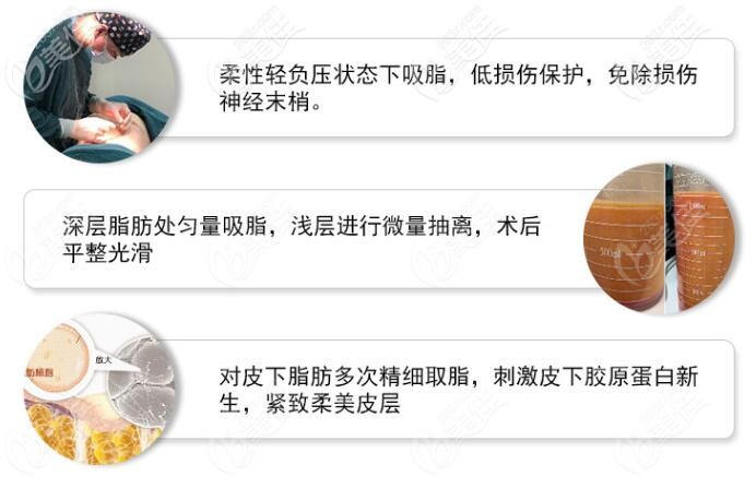 合肥藝星吸脂方式