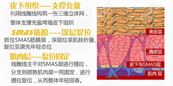 <!--<i data=20240703-sp></i>-->SMAS埋線提升技術(shù)優(yōu)勢(shì) <!--<i data=20240703-sp></i>-->SMAS埋線提升技術(shù)優(yōu)勢(shì)