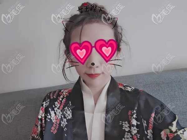 廣州荔醫(yī)種植2000毛囊的發(fā)際線效果圖