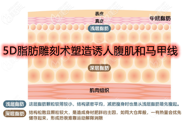 5D吸脂雕刻術(shù)深入深層淺層脂肪