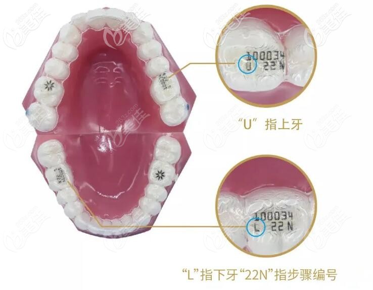 上下牙套各自的標(biāo)志