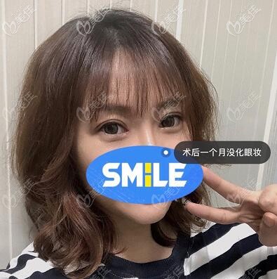 眼修復(fù)術(shù)后一個(gè)月照 眼修復(fù)術(shù)后一個(gè)月照