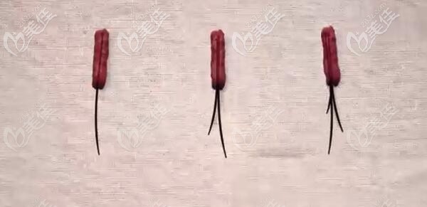 里取出來將要分離的毛囊單位