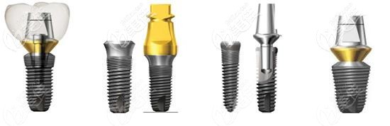 韓國dio種植體是什么材質(zhì)