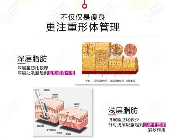 大同清木吸脂方式示意圖