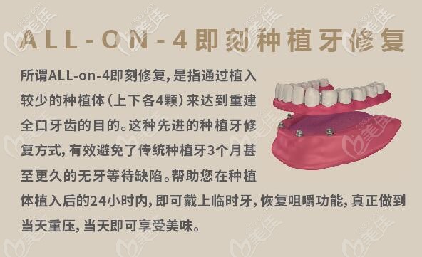 <!--<i data=20240703-sp></i>-->健皓口腔ALL-on-4即刻負(fù)重種植牙 <!--<i data=20240703-sp></i>-->健皓口腔ALL-on-4即刻負(fù)重種植牙