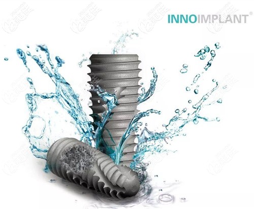 韓國伊諾種植體 韓國伊諾種植體