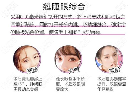 大同清木雙眼皮優(yōu)勢 大同清木雙眼皮優(yōu)勢