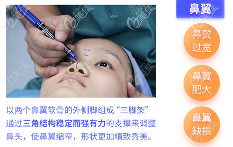 珠海韓妃周國(guó)偉醫(yī)生隆鼻技術(shù)優(yōu)勢(shì) 珠海韓妃周國(guó)偉醫(yī)生隆鼻技術(shù)優(yōu)勢(shì)