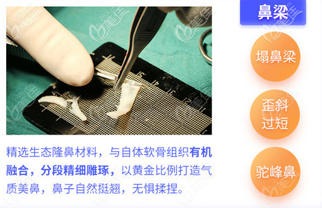 珠海韓妃周國(guó)偉鼻假體雕刻過程 珠海韓妃周國(guó)偉鼻假體雕刻過程