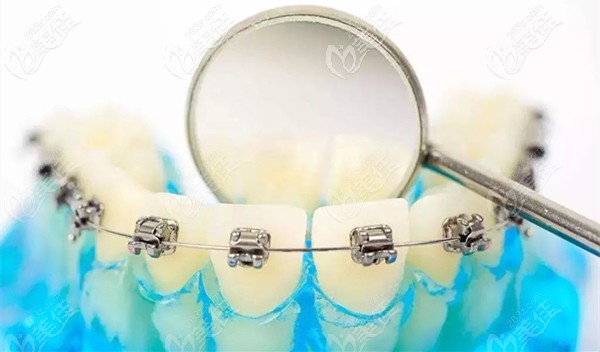 我國專業(yè)的正畸醫(yī)生目前只有5千多人