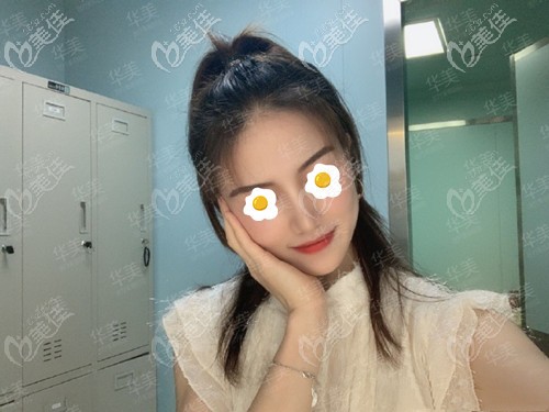 南寧盧志剛醫(yī)生做軟糖肋骨鼻怎么樣?找他做過鼻子的我說一下效果