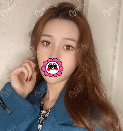 熱瑪吉對(duì)眼紋多久有效果?我做完2月左右效果就明顯了