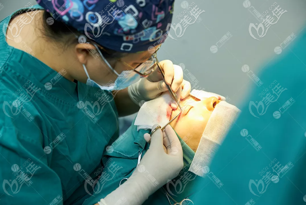 廣州曙光范丹醫(yī)生雙眼皮修復(fù)技術(shù)了得 廣州曙光范丹醫(yī)生雙眼皮修復(fù)技術(shù)了得