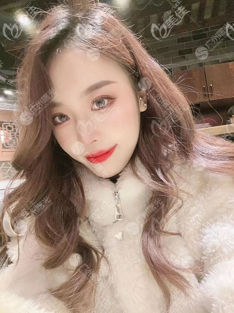 我在廣州曙光做過(guò)雙眼皮修復(fù),推薦曙光雙眼皮修復(fù)好的醫(yī)生給你