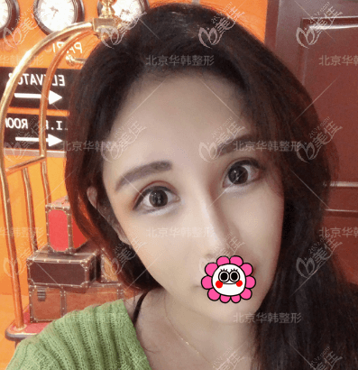 做熱拉提第8天了 做熱拉提第8天了