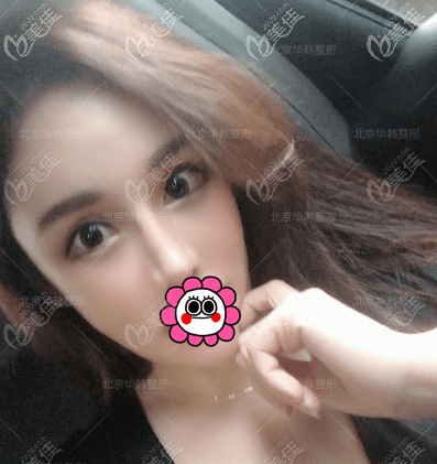 北京華韓熱拉提plus美膚案例效果 北京華韓熱拉提plus美膚案例效果