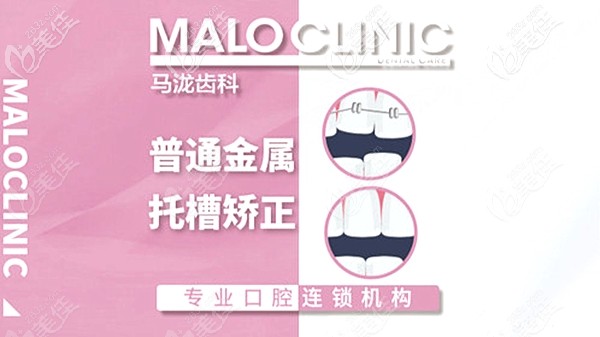 鄭州馬瀧齒科牙齒矯正/正畸價(jià)格表