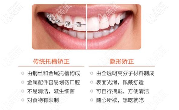 隱形矯正和傳統(tǒng)矯正的區(qū)對比圖 隱形矯正和傳統(tǒng)矯正的區(qū)對比圖