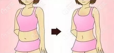 三亞做吸脂好的醫(yī)院有哪家？