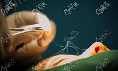 深圳富華整形段春巍醫(yī)生雙眼皮修復(fù)技術(shù)優(yōu)勢(shì) 深圳富華整形段春巍醫(yī)生雙眼皮修復(fù)技術(shù)優(yōu)勢(shì)