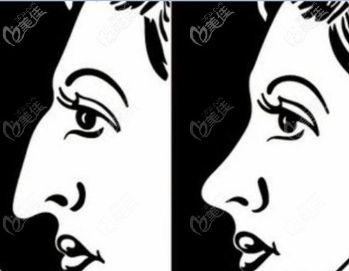 我的鼻子 我的鼻子