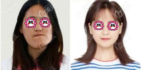 沈陽(yáng)杏林頜面整形