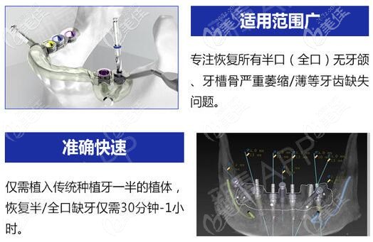 即刻負(fù)重適用廣泛、方便快捷