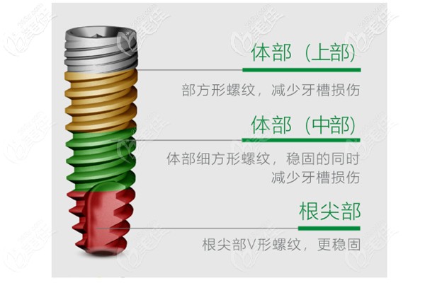 德國(guó)卡瓦abt種植體怎么樣