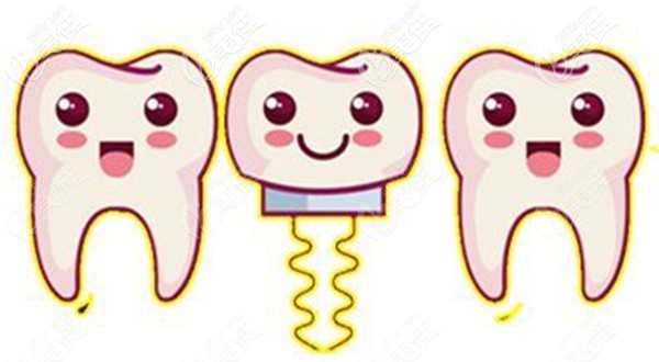 德國(guó)卡瓦abt種植體缺點(diǎn)