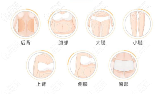 深圳全身吸脂手術(shù)多少錢