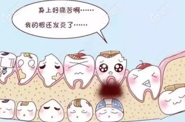 根管治療后悔一輩子