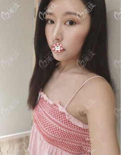 術(shù)前照片 術(shù)前照片