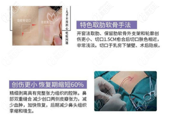 西安美萊做假體隆鼻的技術(shù)優(yōu)勢(shì) 西安美萊做假體隆鼻的技術(shù)優(yōu)勢(shì)