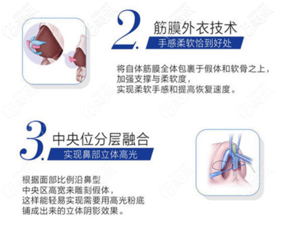 西安美萊做鼻子的技術(shù)優(yōu)勢(shì) 西安美萊做鼻子的技術(shù)優(yōu)勢(shì)
